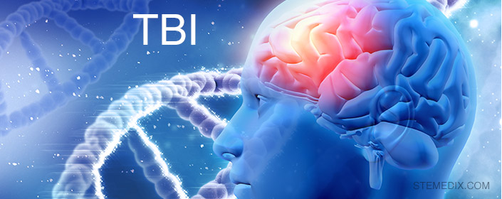 tbi traumatic brain injury