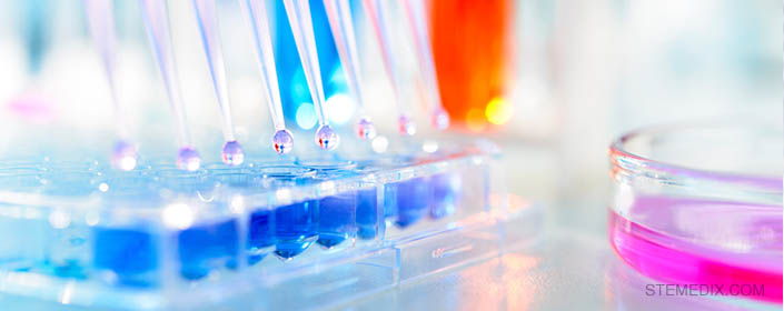 stem cells for lupus
