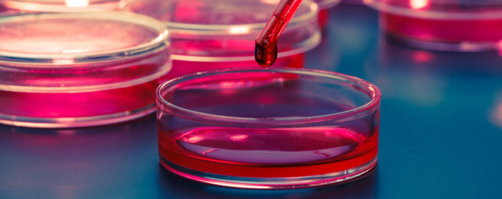 stem cells in petri dish