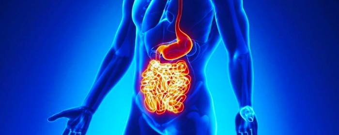 Mesenchymal Stem Cells for Fistulizing Crohn’s Disease - Stemedix ...
