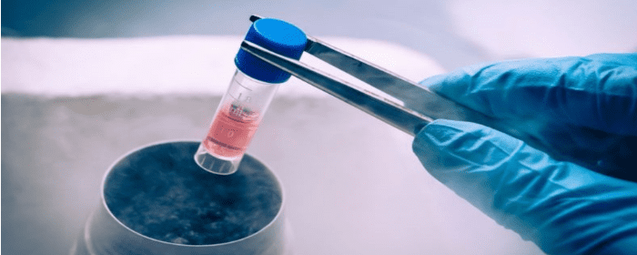 Stem Cells Derived from Wharton’s Jelly and Bone Marrow Show Distinct Properties