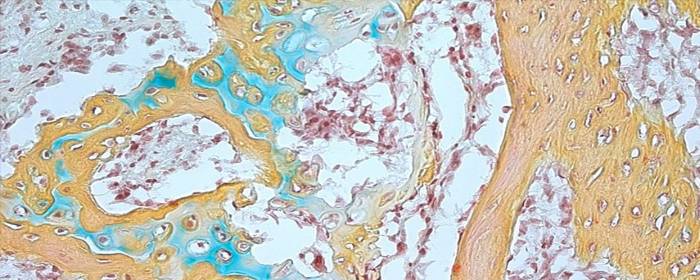 Scientists have discovered skeletal stem cells in humans