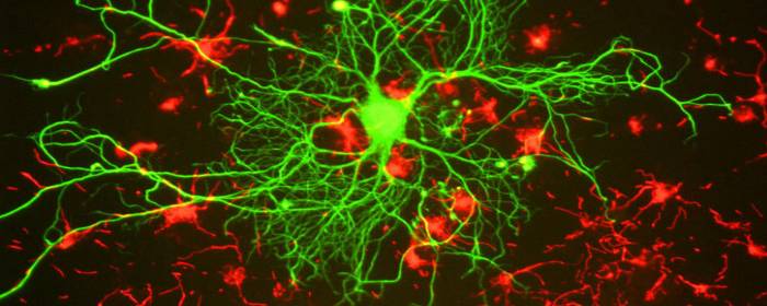 Stem Cells Reverse Paralysis Caused by Spinal Cord Injury
