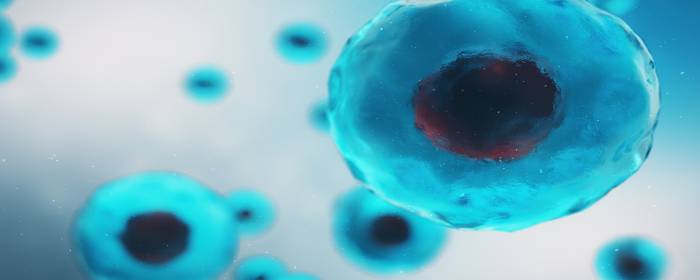 Use of Stem Cells to Treat Perianal Crohn’s Disease