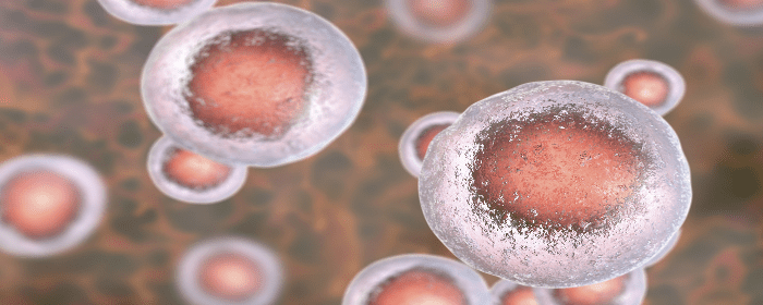 Study On Stem Cell Therapy For Crohn s Stemedix