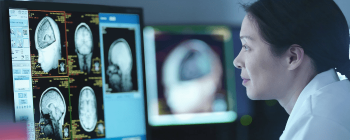 Advancing Stem Cell Treatment for Traumatic Brain Injury