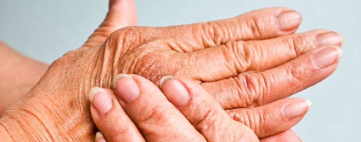 Stem Cell Therapy Can Help to Treat Rheumatoid Arthritis | Stemedix