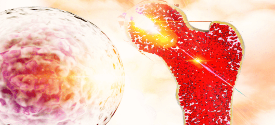 What Are Bone Marrow Stem Cells?