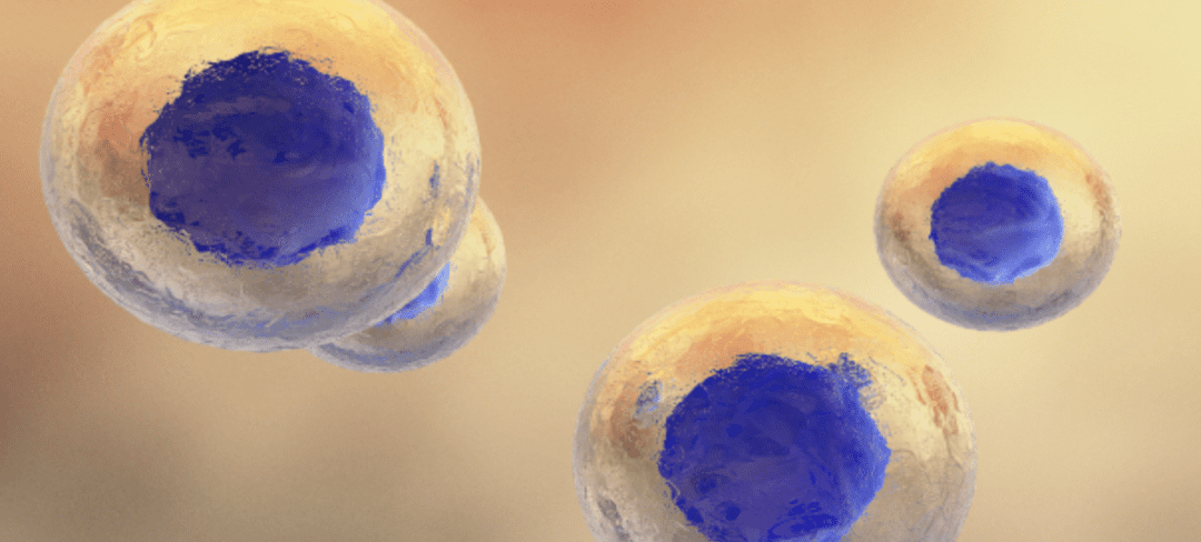 Stem Cell Therapy for Pain