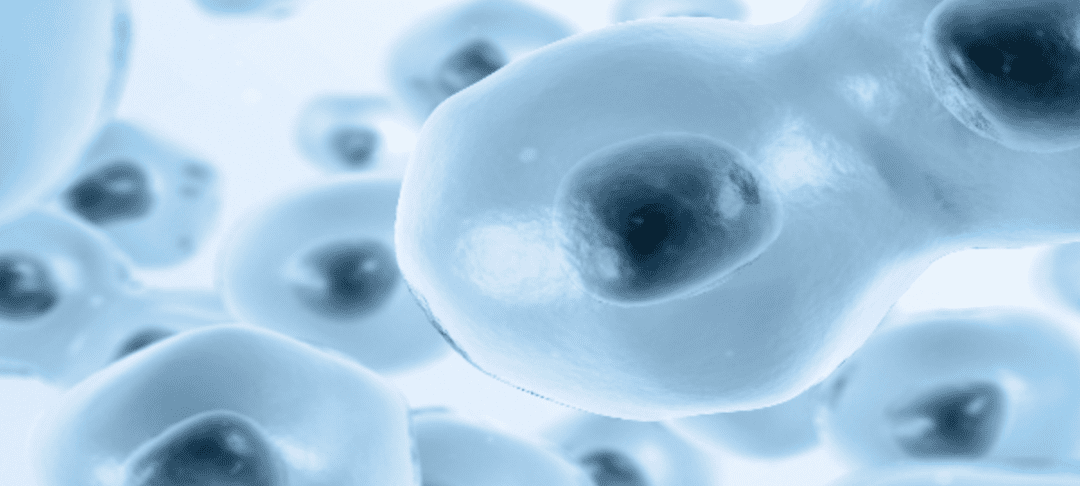 Stem Cells Can Help Patients With MS