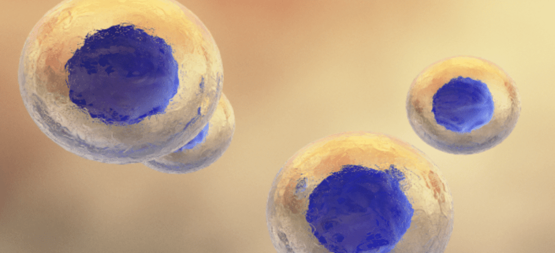 Stem Cells For Autoimmune Diseases: MSCs