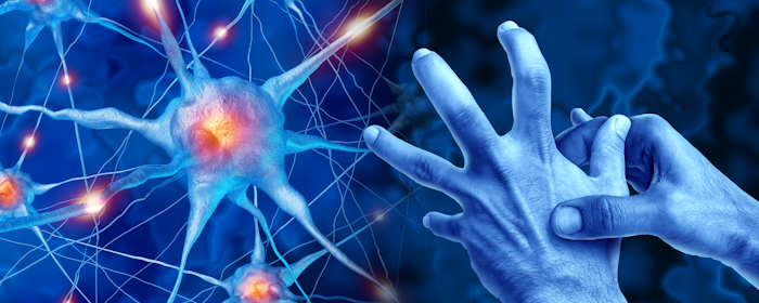 The Potential of Mesenchymal Stem Cells in Parkinson’s Disease Treatment