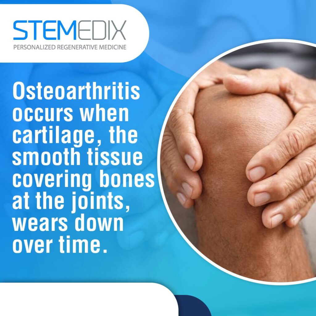 Role of Inflammation in Osteoarthritis Progression
