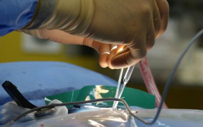 Choosing the Best Regenerative Medicine Treatment for Your Spinal Cord Injury in Saint Petersburg, FL