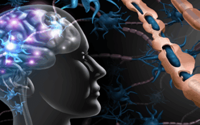 Neural Stem Cell Therapy: A New Hope for Progressive Multiple Sclerosis