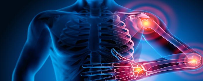 Mesenchymal Stem Cell Therapy for Rheumatic Diseases
