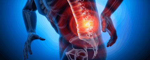 Fibrin Sealant Injections A Promising Regenerative Approach For Chronic Low Back Pain | Stemedix