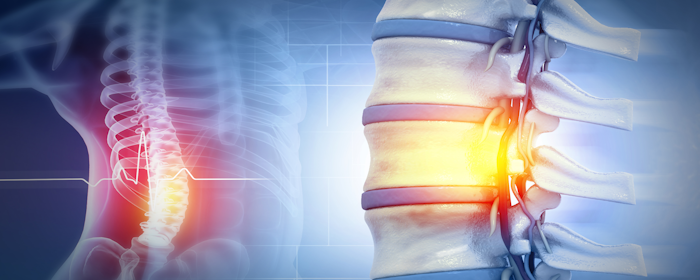 Spinal Cord Injury and the Promise of Stem Cell Therapy