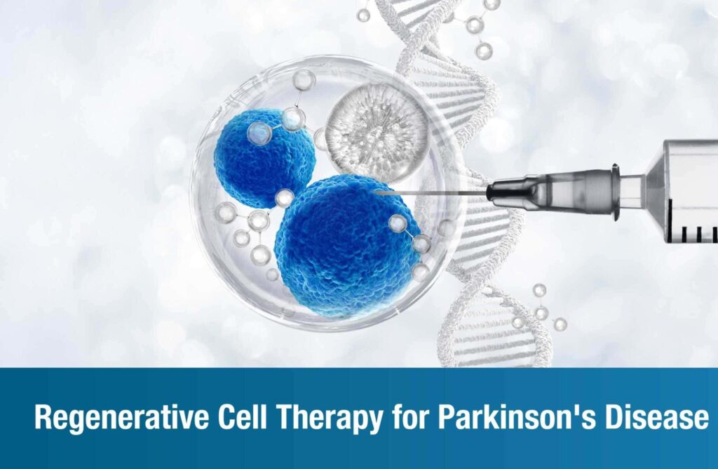 3D illustration of blue stem cells in a transparent sphere with a syringe and DNA helix, titled "Regenerative Cell Therapy for Parkinson's Disease"