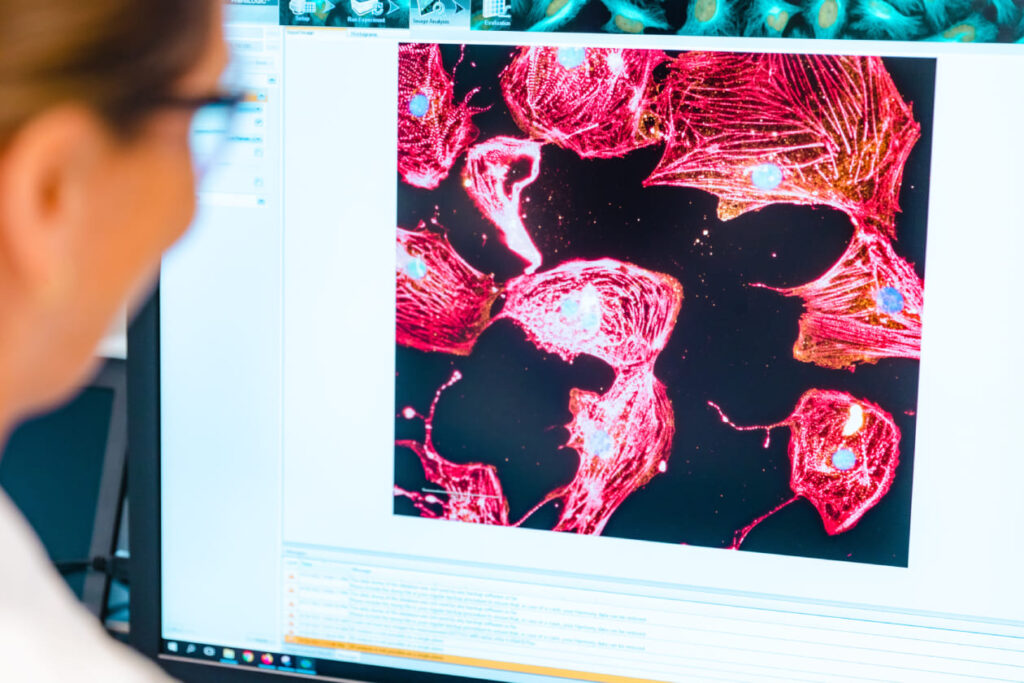 Scientist viewing fluorescent microscopy images of cells with red-stained cytoskeletons and blue nuclei on a computer monitor