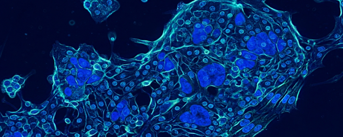 Mesenchymal Stem Cells and Neuropathic Pain: Exploring Regenerative Support for Nerve Repair