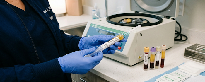 Platelet-Rich Plasma and Lumbar Disc Herniation: Exploring PRP’s Role in Spine Recovery