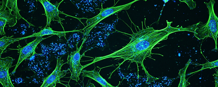 Can Combining Umbilical Cord MSCs Make Regenerative Therapies More Consistent?