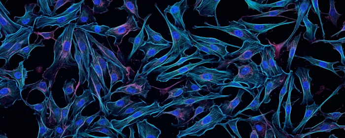 Umbilical Cord-Derived MSCs and Cardiac Function: Exploring the Potential of Repeat Infusions
