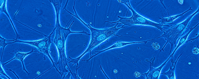 Umbilical Cord MSC Secretome and Lupus: Exploring a Cell-Free Approach